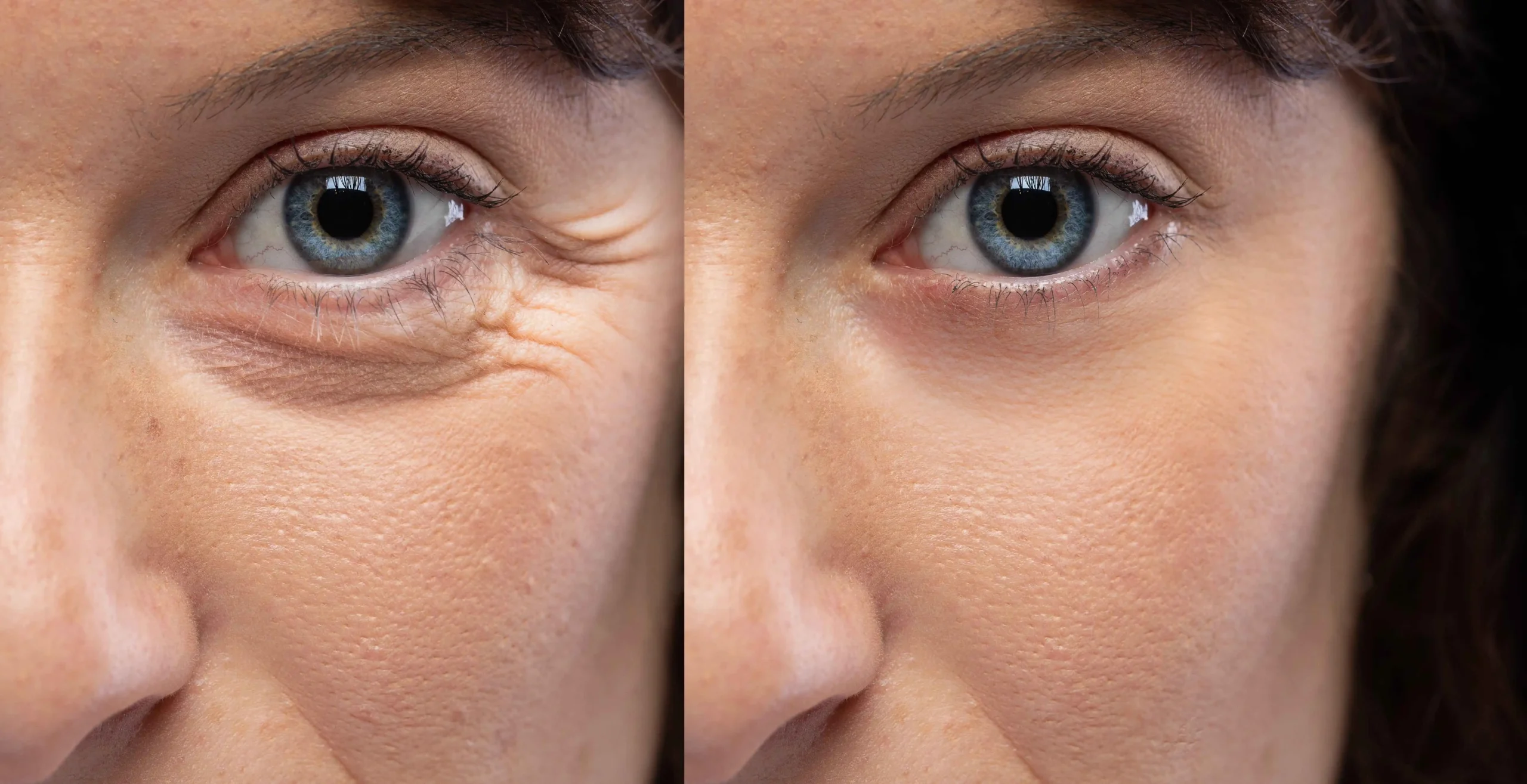 Wrinkle Relaxers